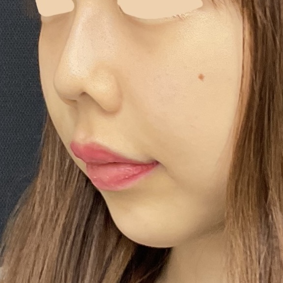 After