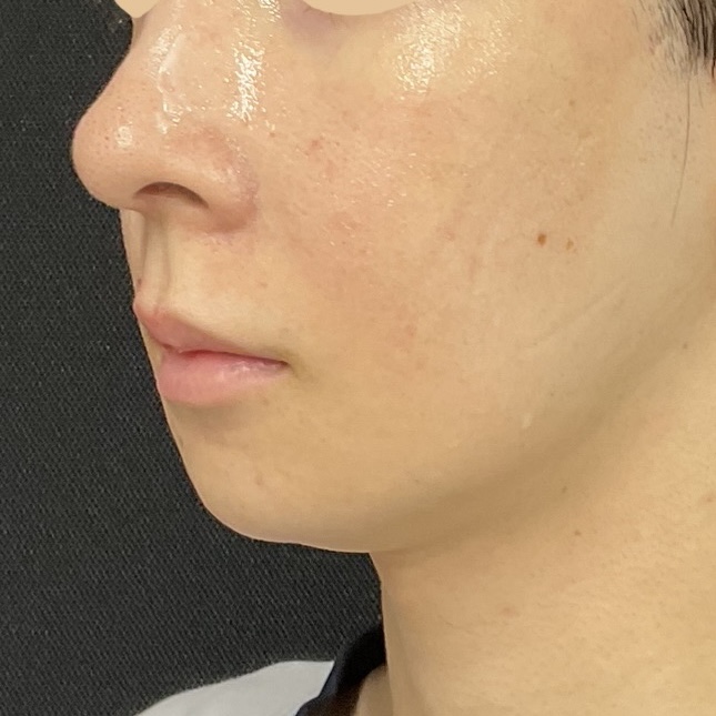 Before