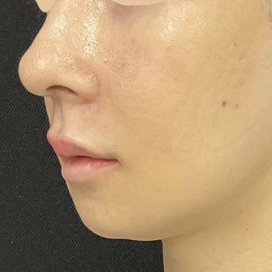 After