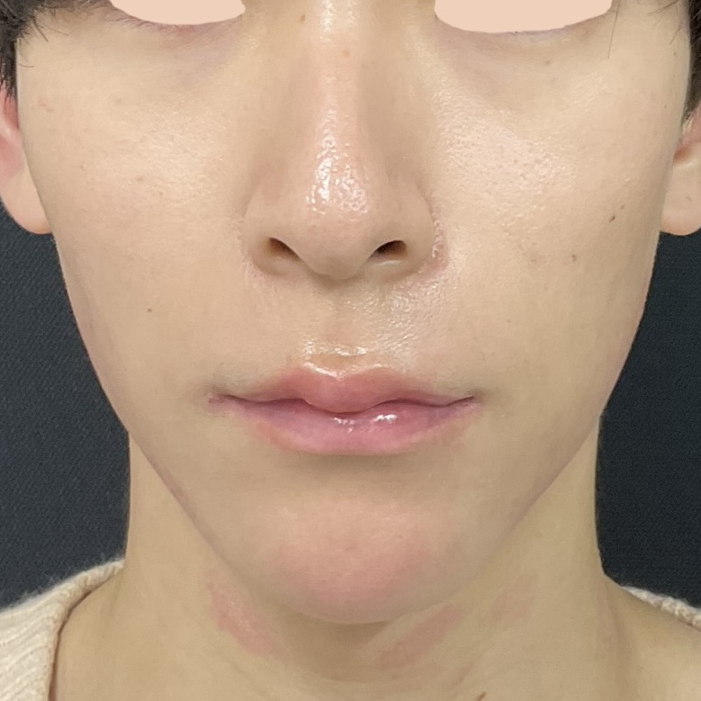 After