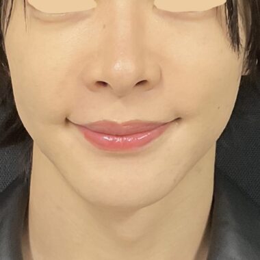 After