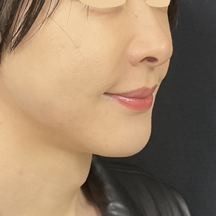 After