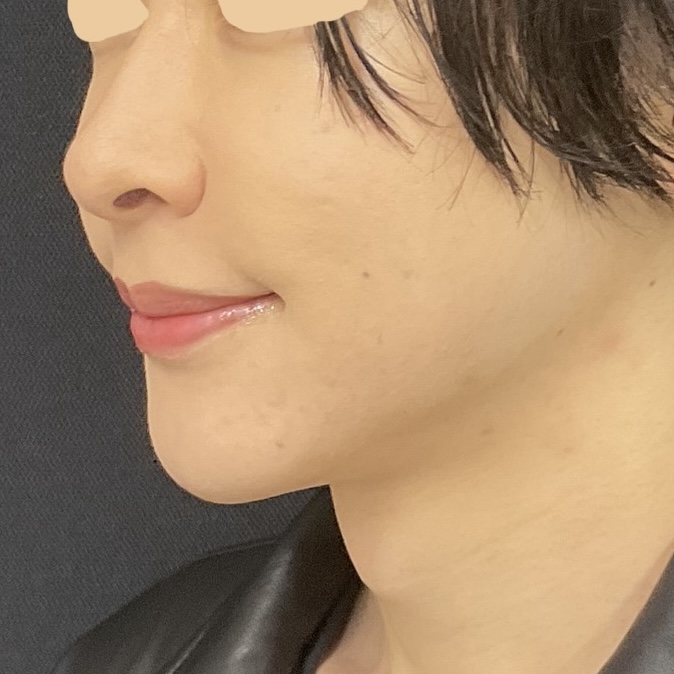 After
