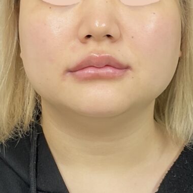 After