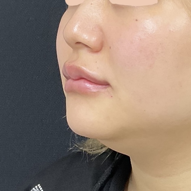 After