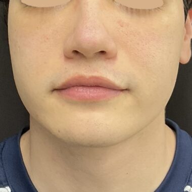 After