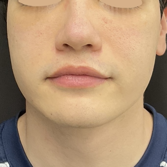 After
