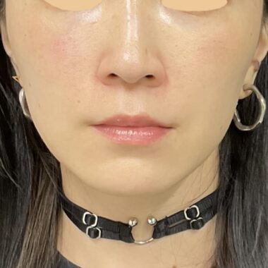 After