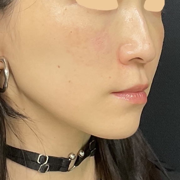 After