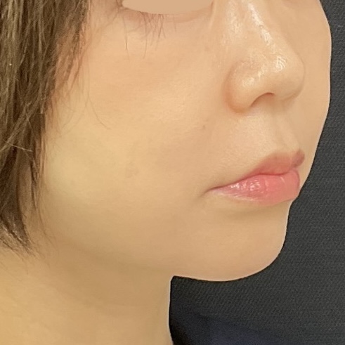 After