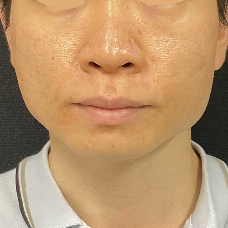 Before