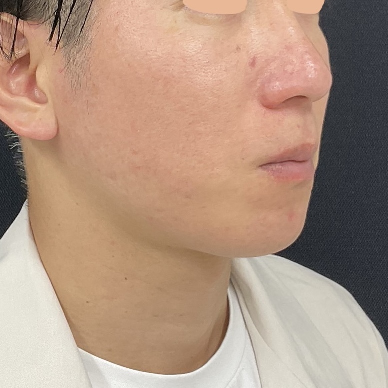 Before
