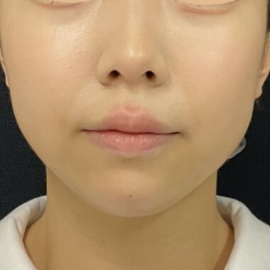 After
