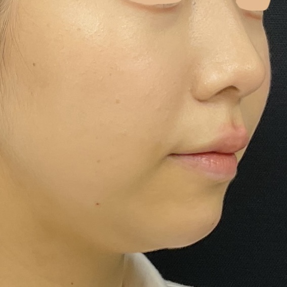 After