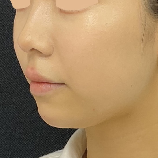 After