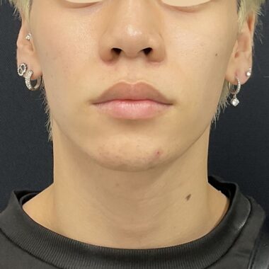After