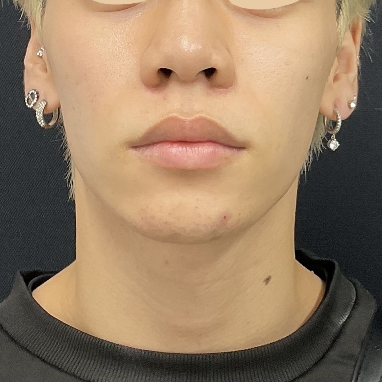 After