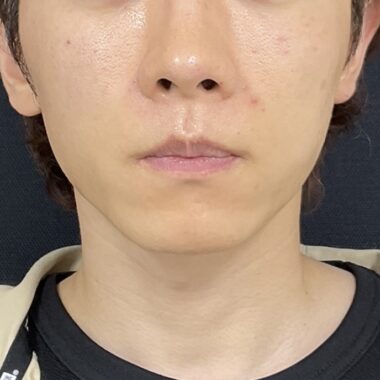 After