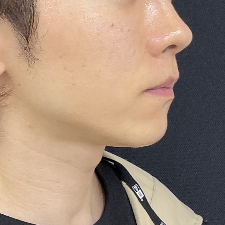 After
