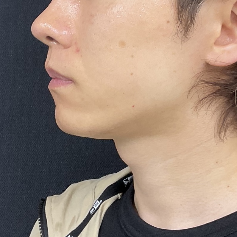 After