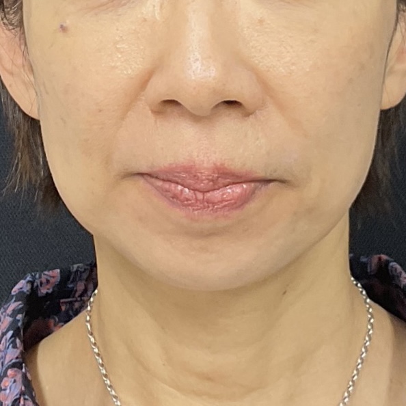After
