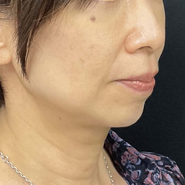 After