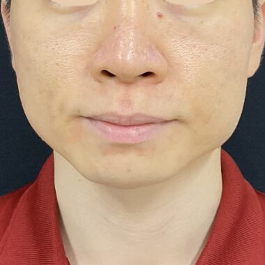 After