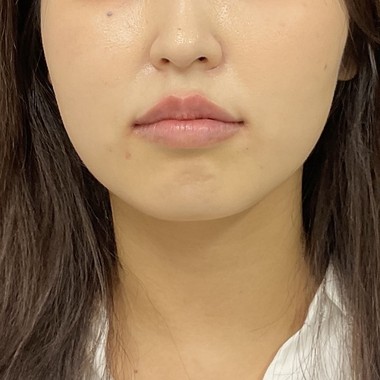 After