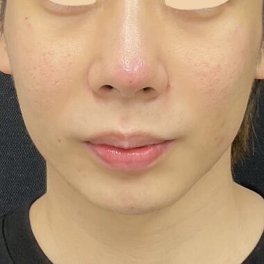 After