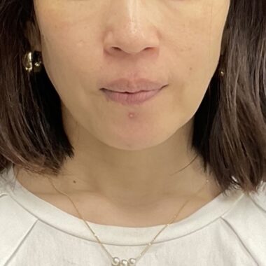 After