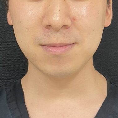 Before