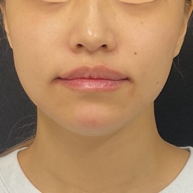 After