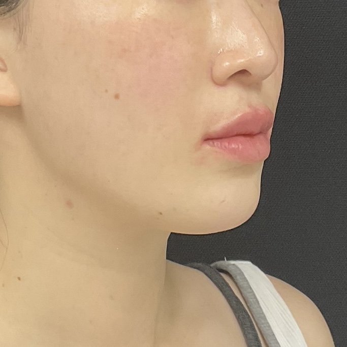 After