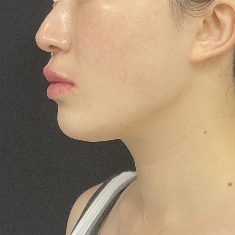 After