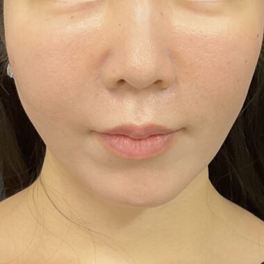 After