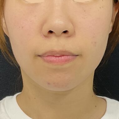After