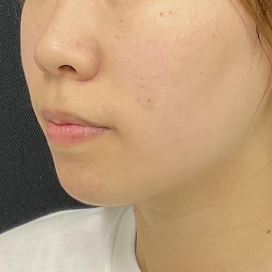 After