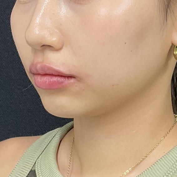 After