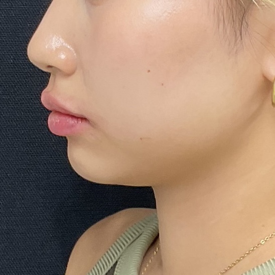 After