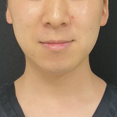 After