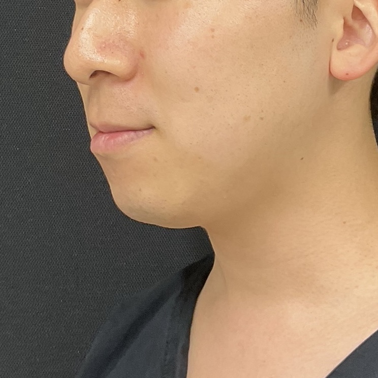 After