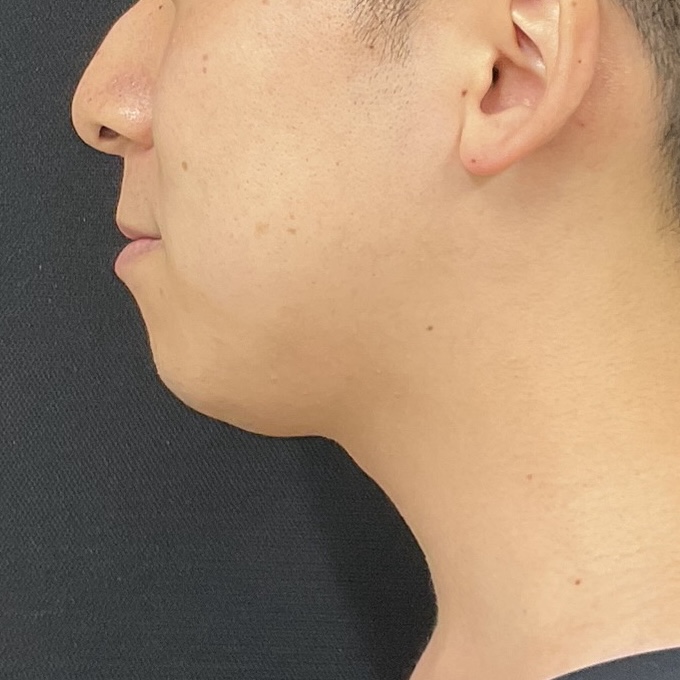 After