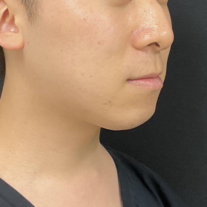 After