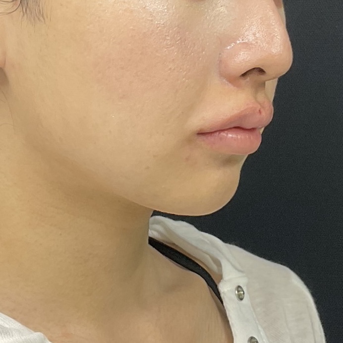 After