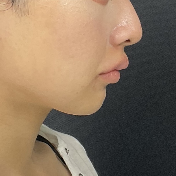 After