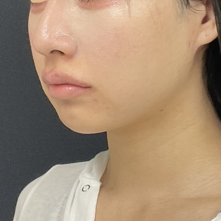 After