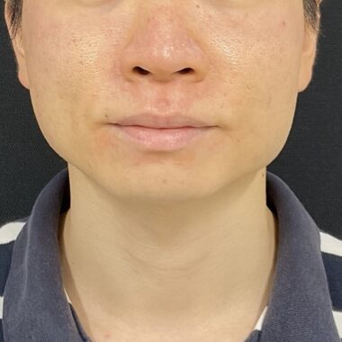 After