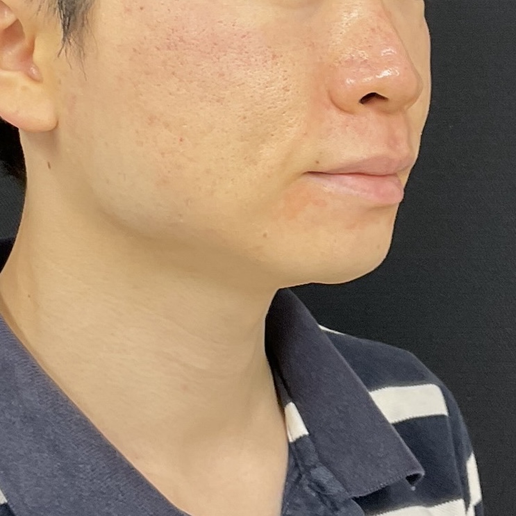 After