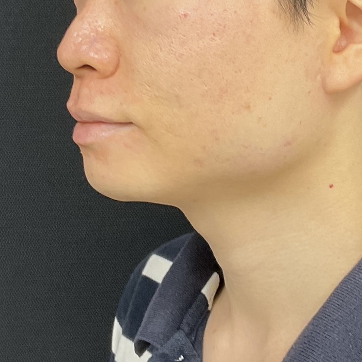 After