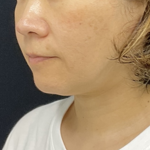 After
